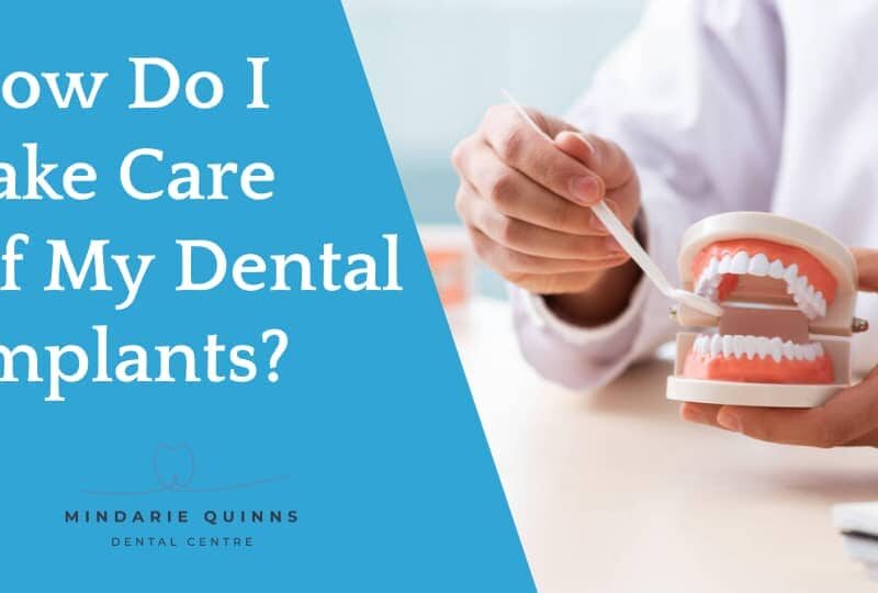 How Do I Take Care of My Dental Implants Mindarie Quinns