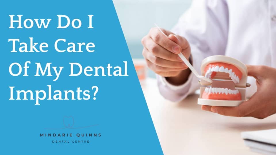 Take Care Of Dental Implants