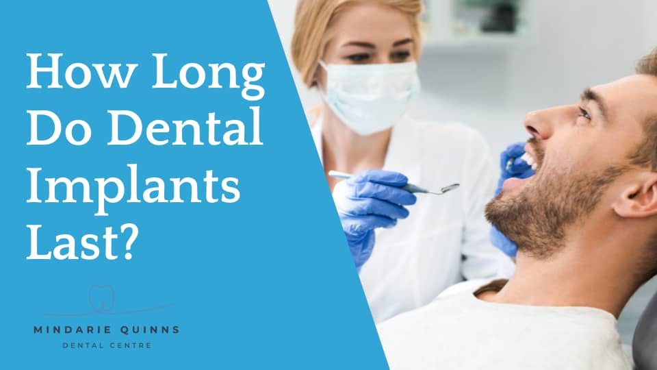 Dental implants lifespan and maintenance tips